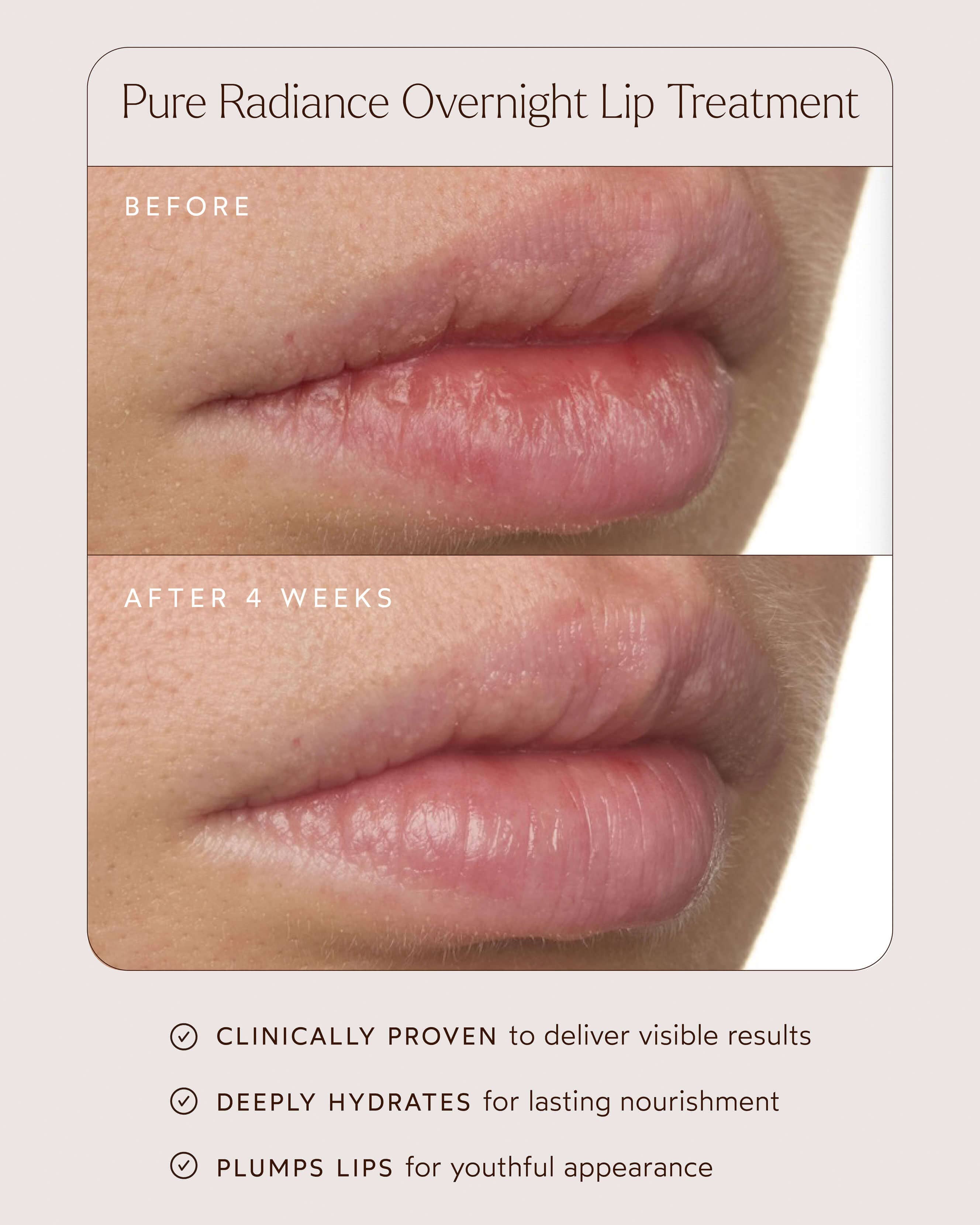 Pure Radiance Overnight Lip Treatment 4