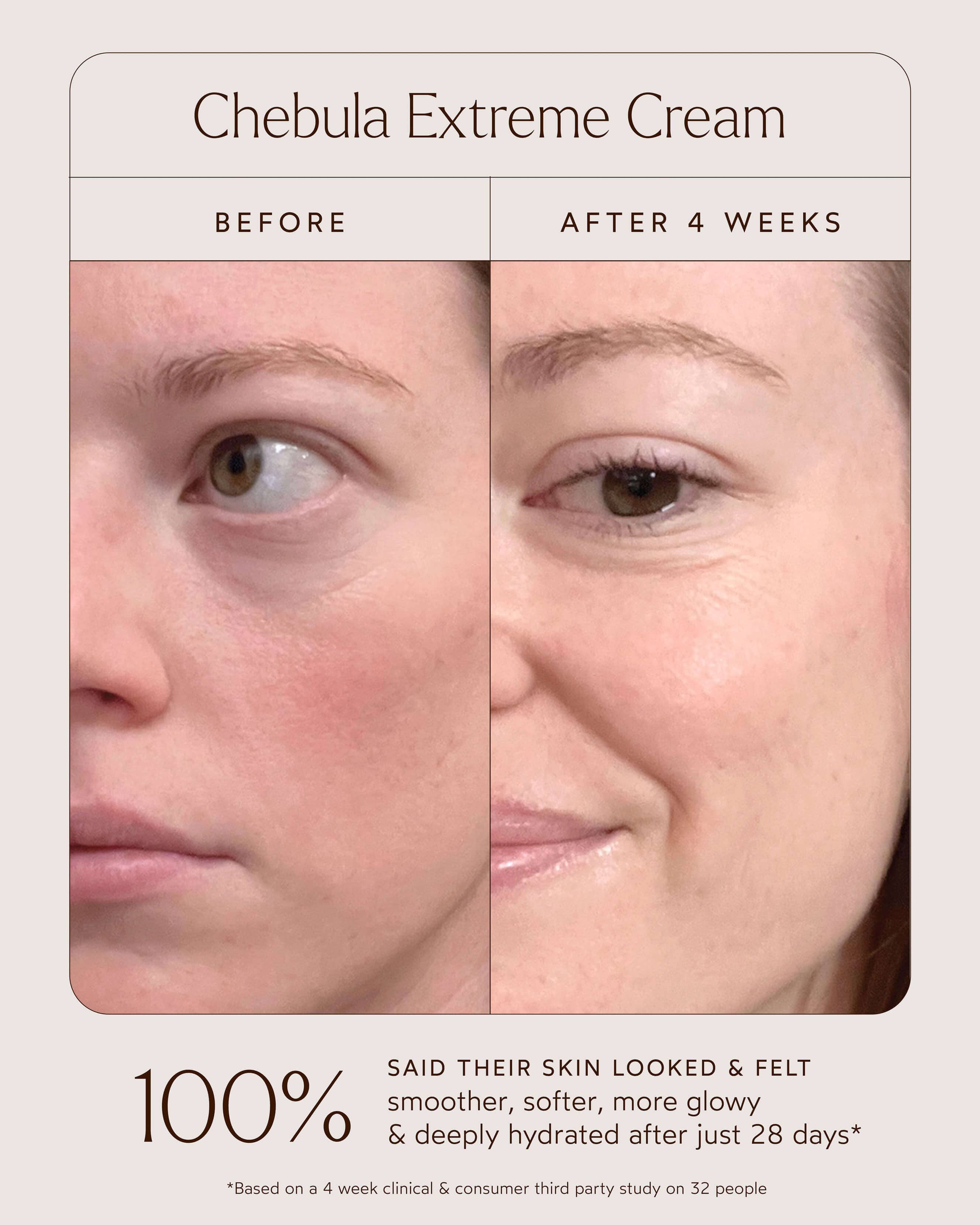 Chebula Extreme Cream 10