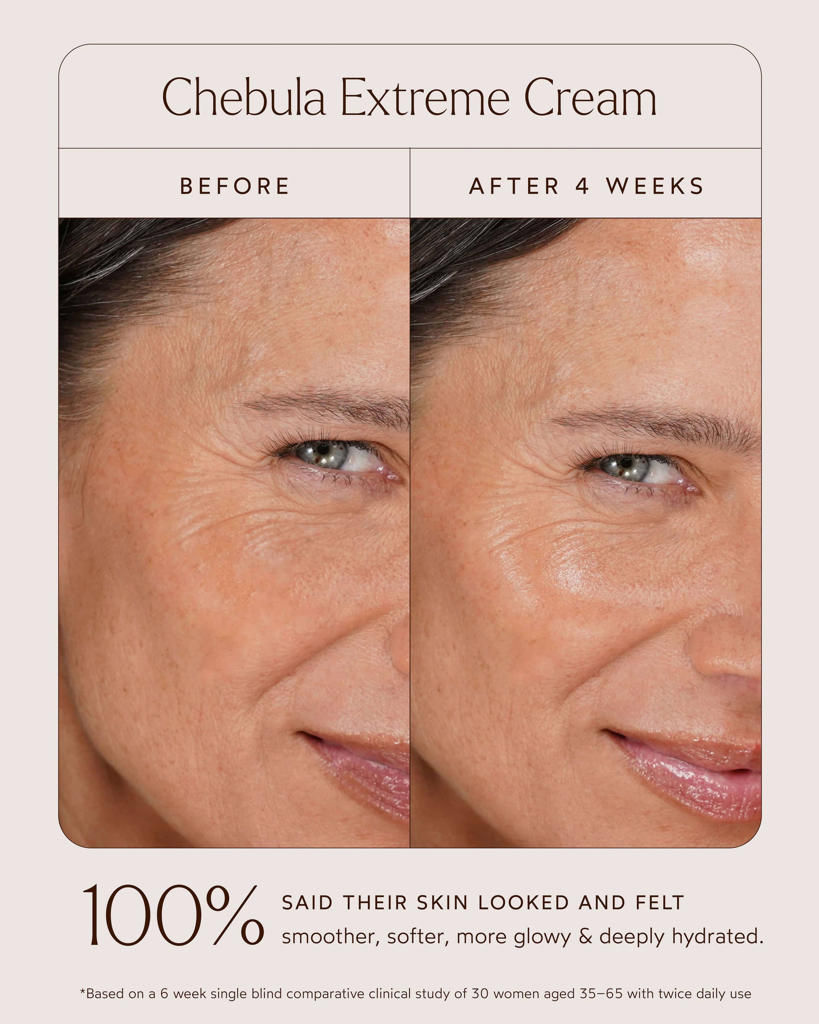 Chebula Extreme Cream 11