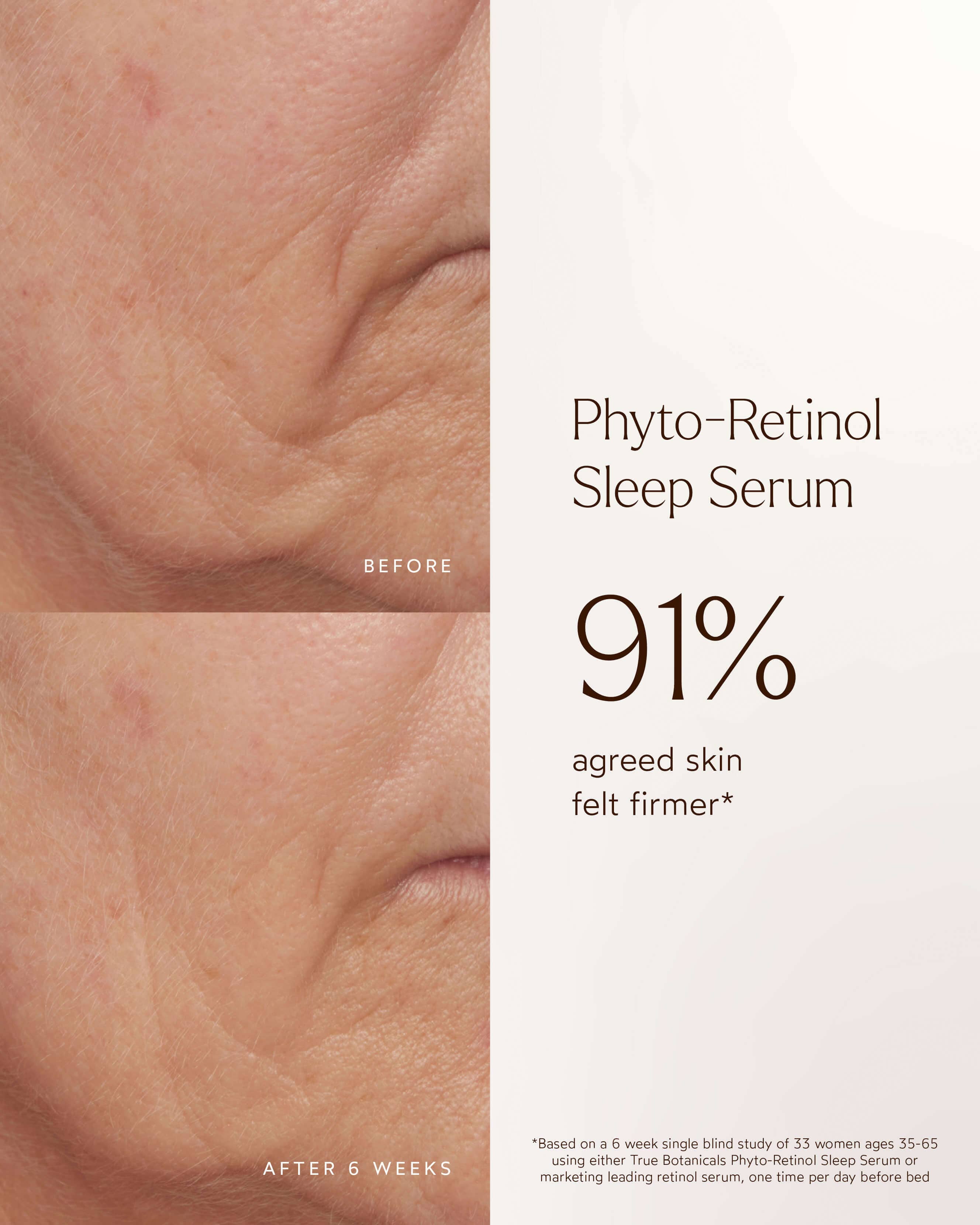 Phyto-Retinol Clinical Serum 6
