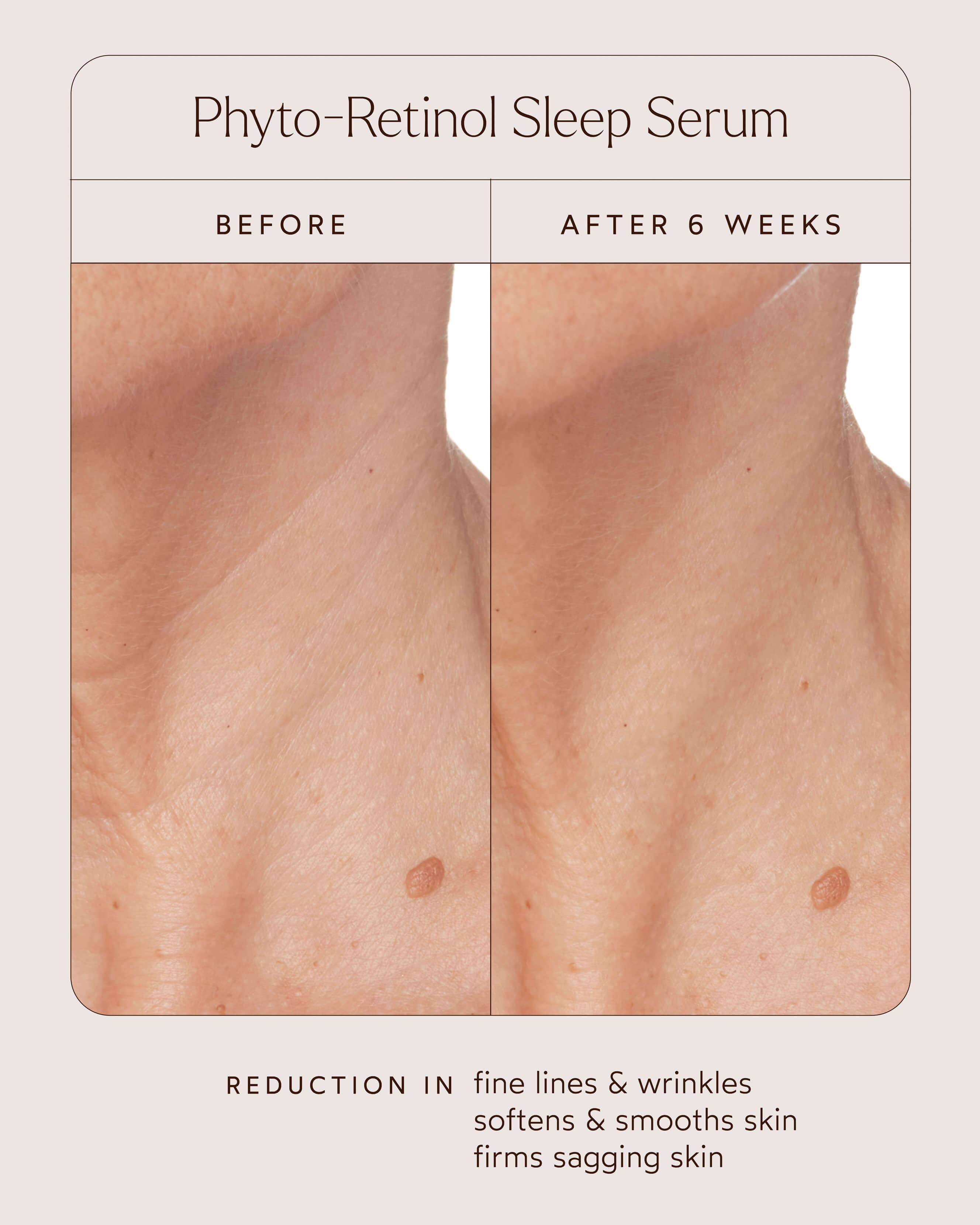 Phyto-Retinol Clinical Serum 5