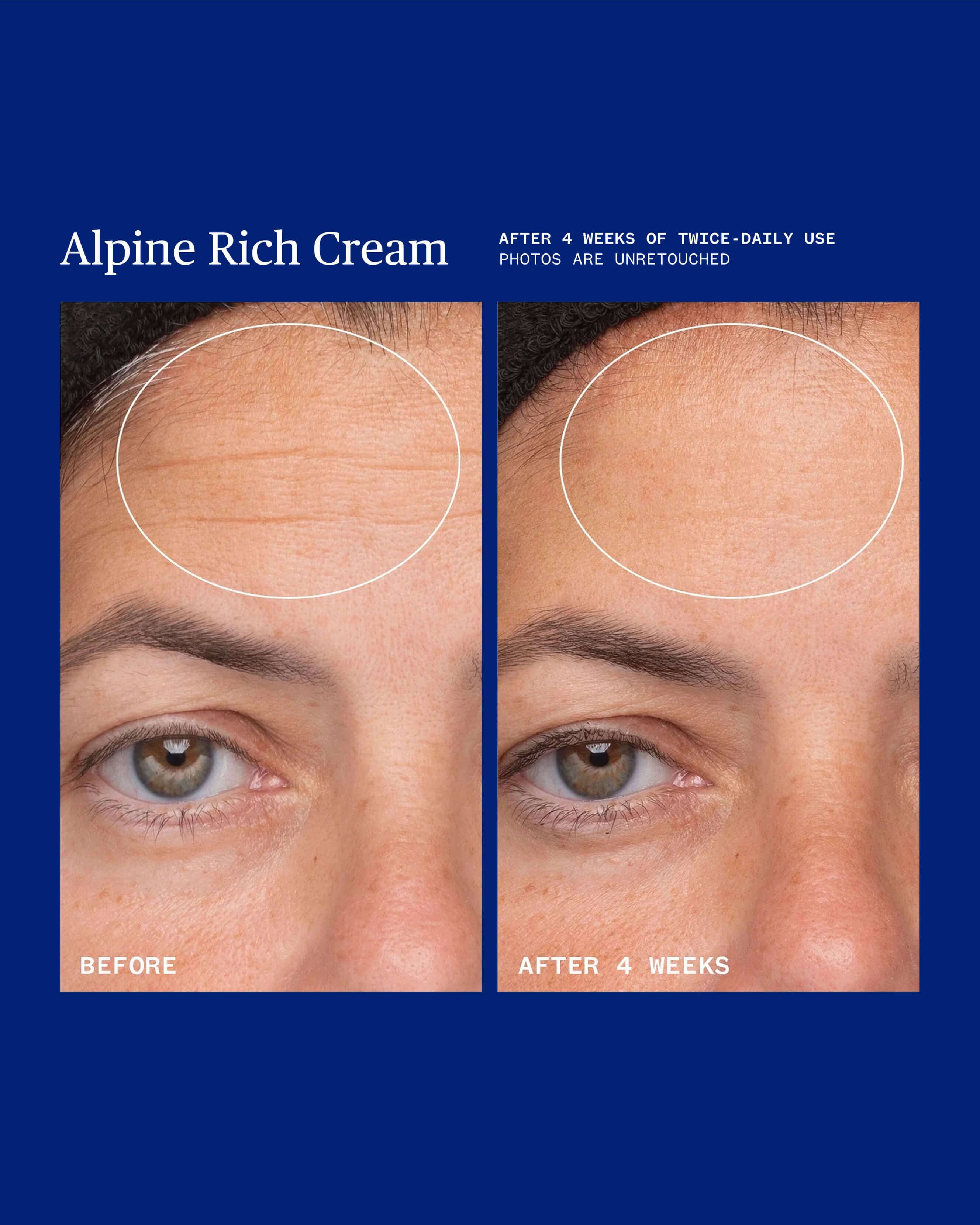 Alpine Rich Cream | Dry Skin's Dream Come True
– Ursa Major Skincare 4
