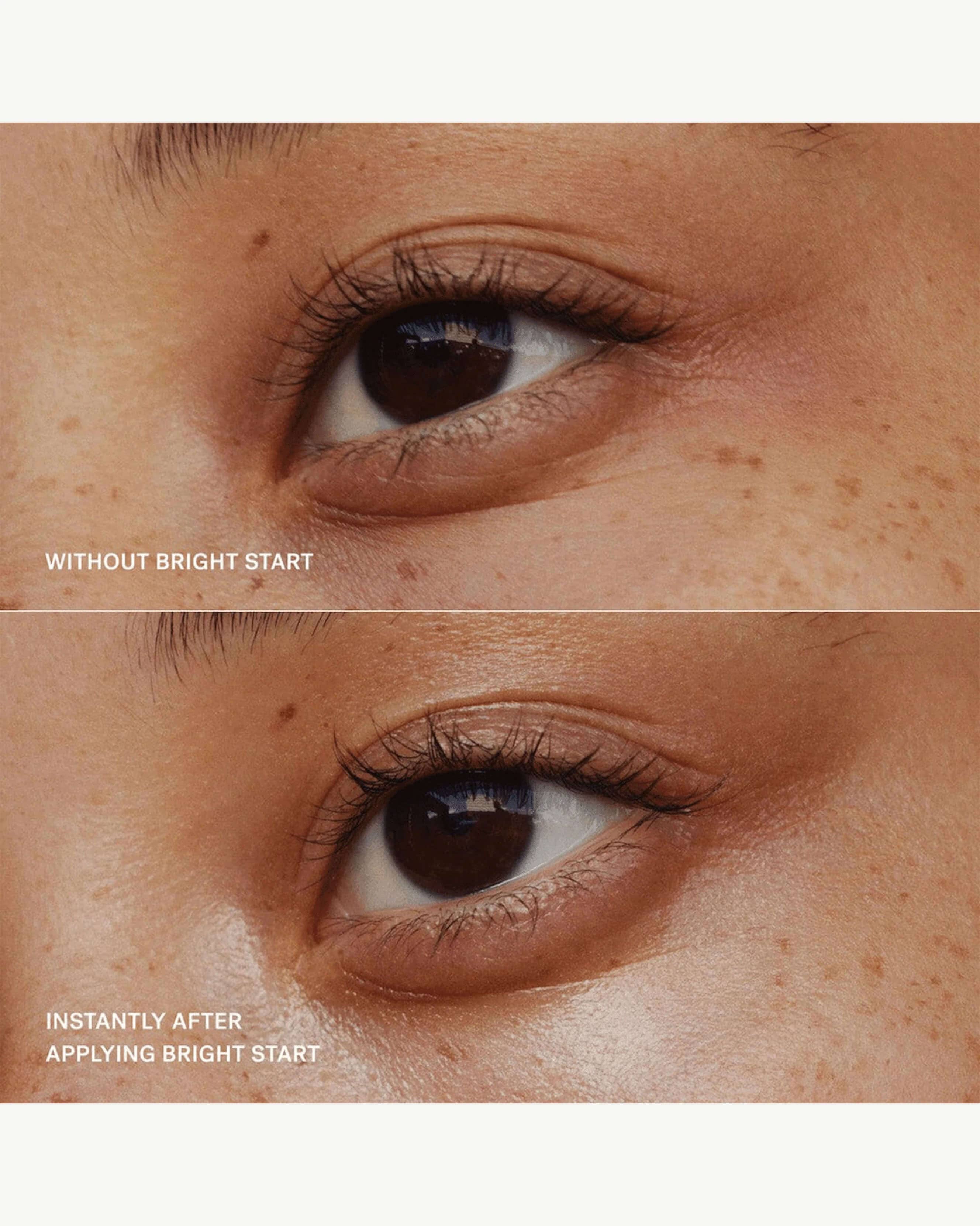 Bright Start Retinol Alternative Eye Cream 9