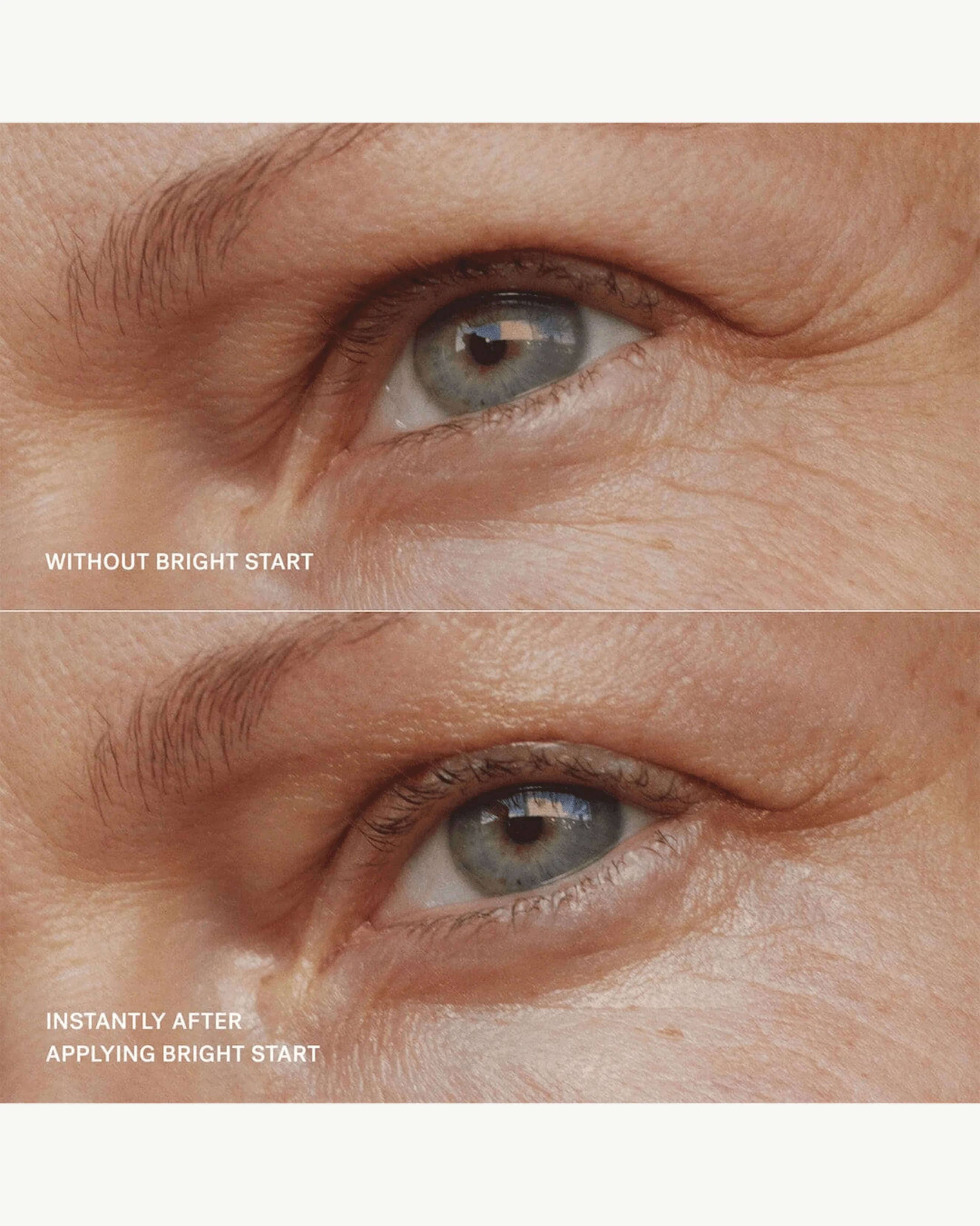 Bright Start Retinol Alternative Eye Cream 10