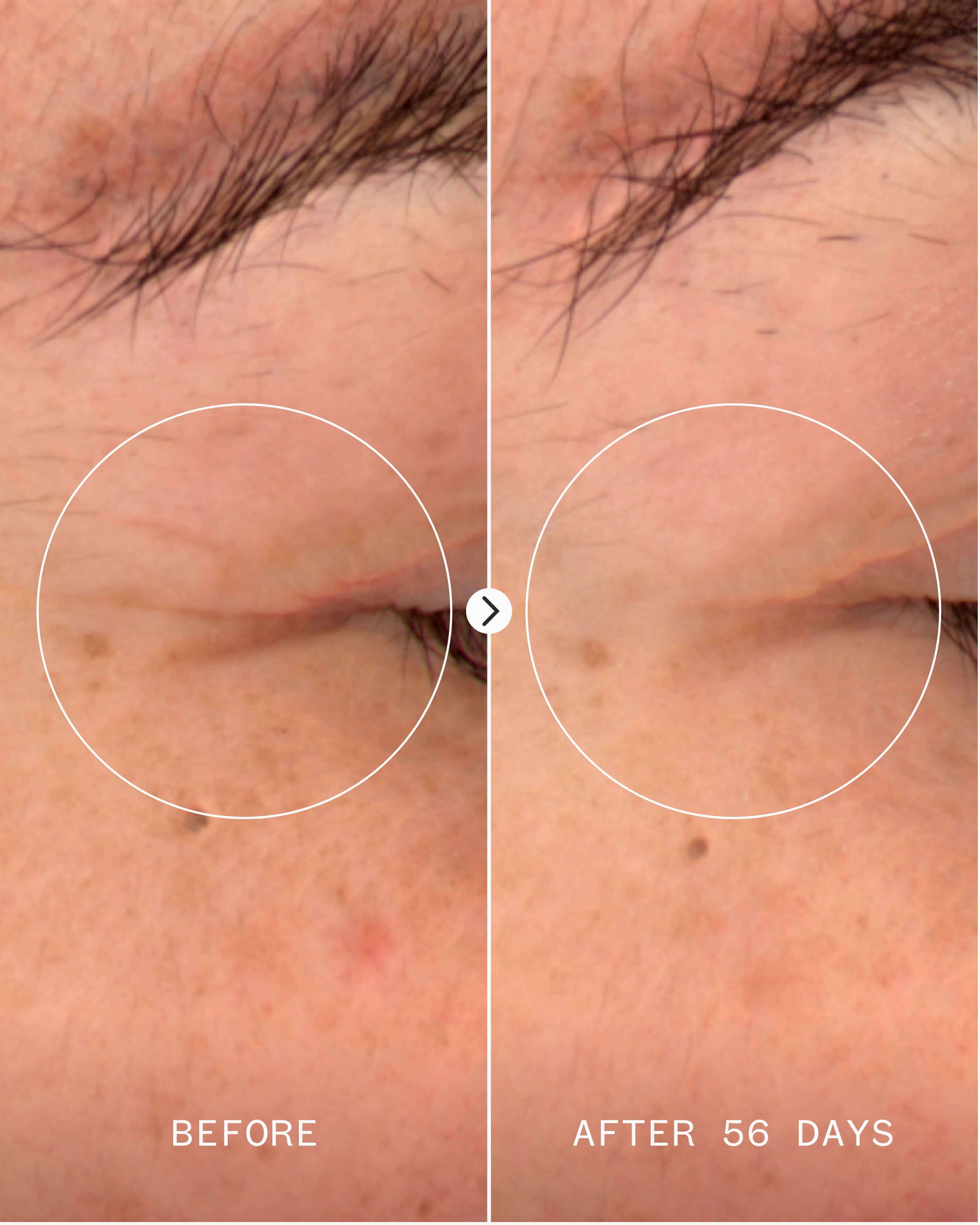 Age Confidence™ NAD+ & TriPeptide Renewal Serum 4