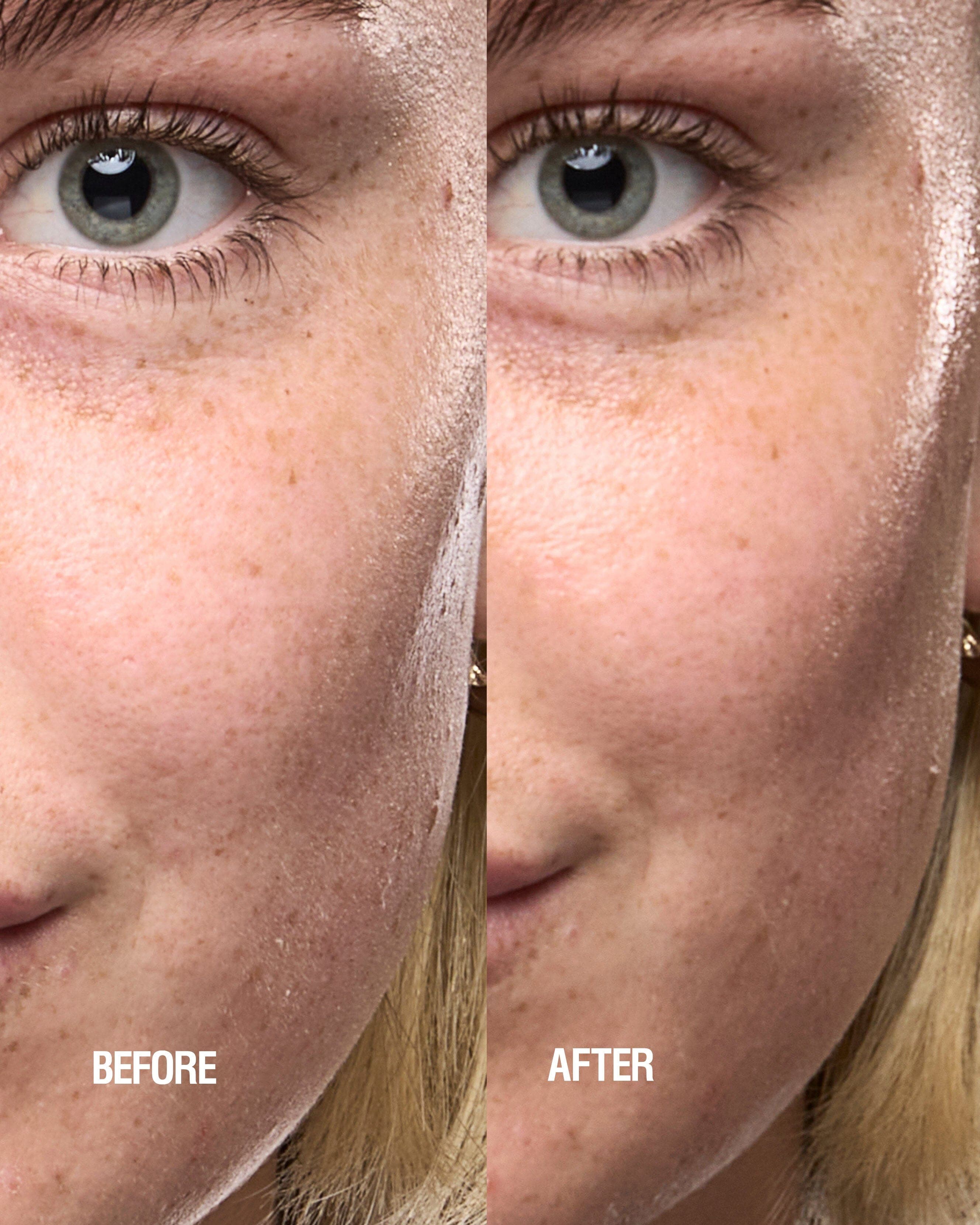 Skin Renewal Serum (25mL) 5