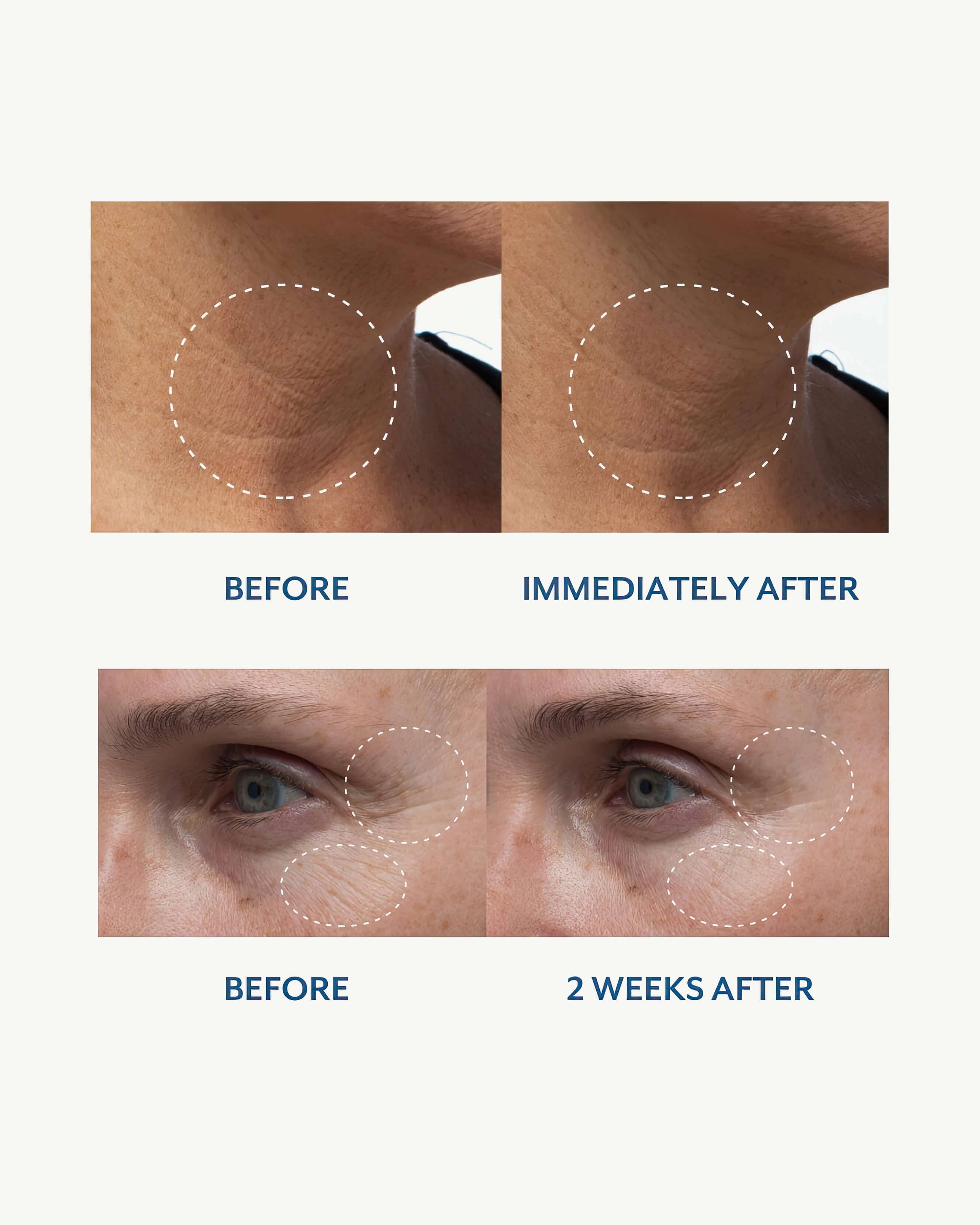 Royal Tulip Moisturizing Nectar 5