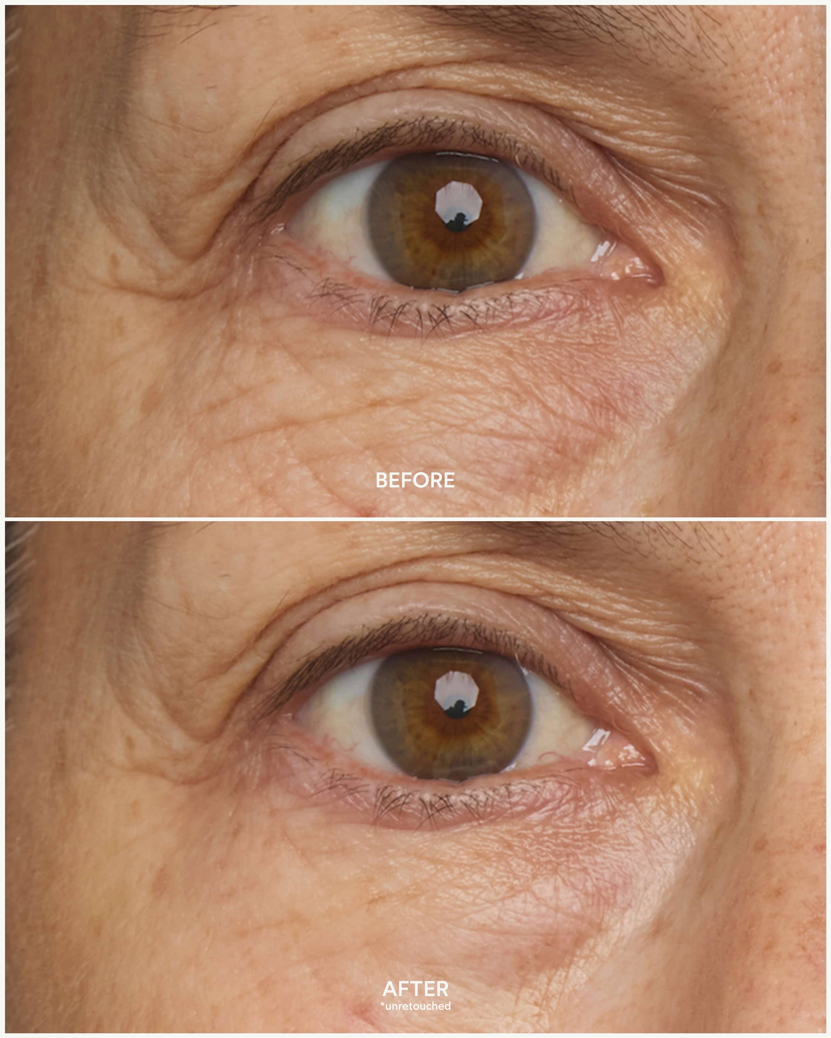 Chebula Multi-Corrective Eye Patches 5