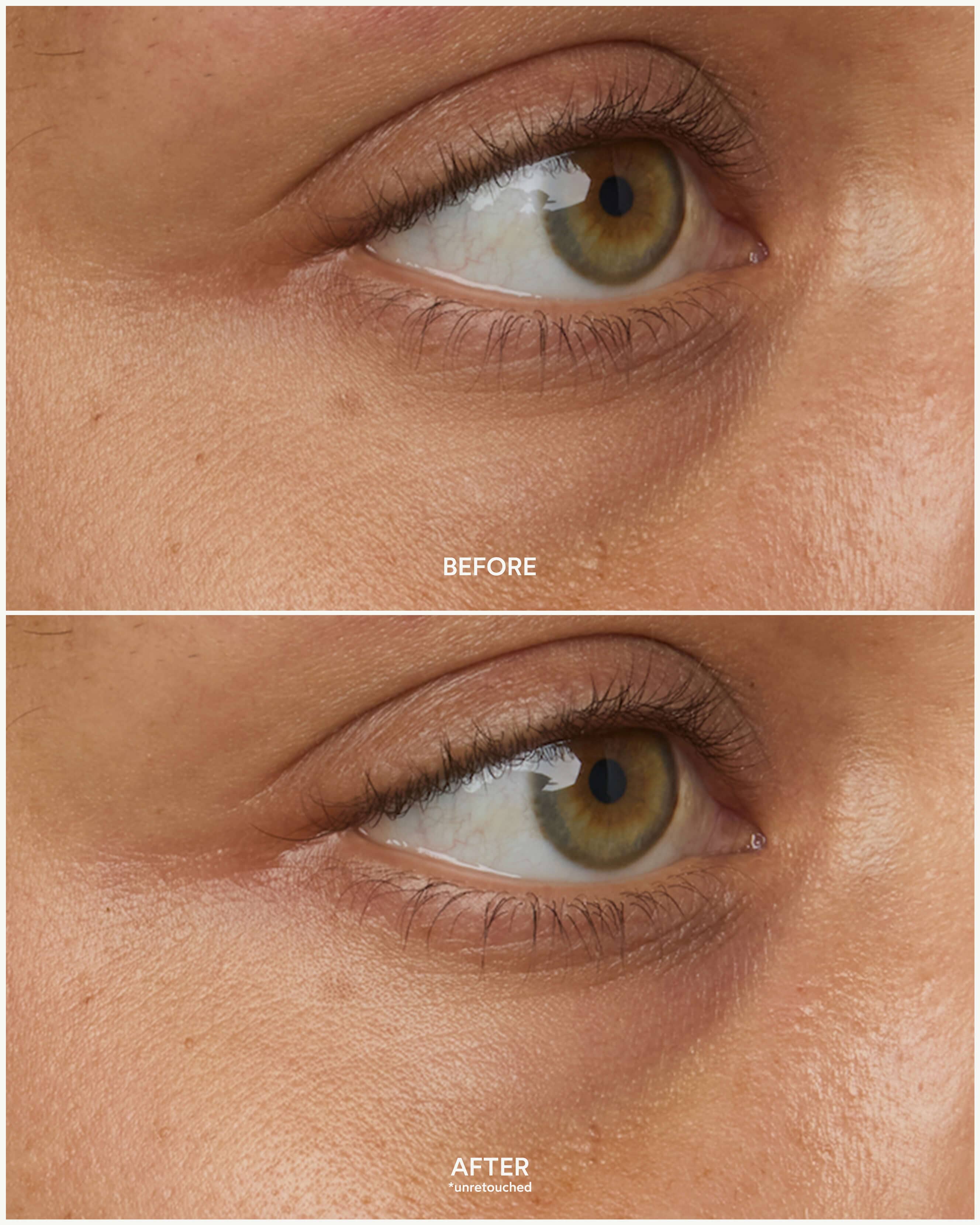 Chebula Multi-Corrective Eye Patches 6