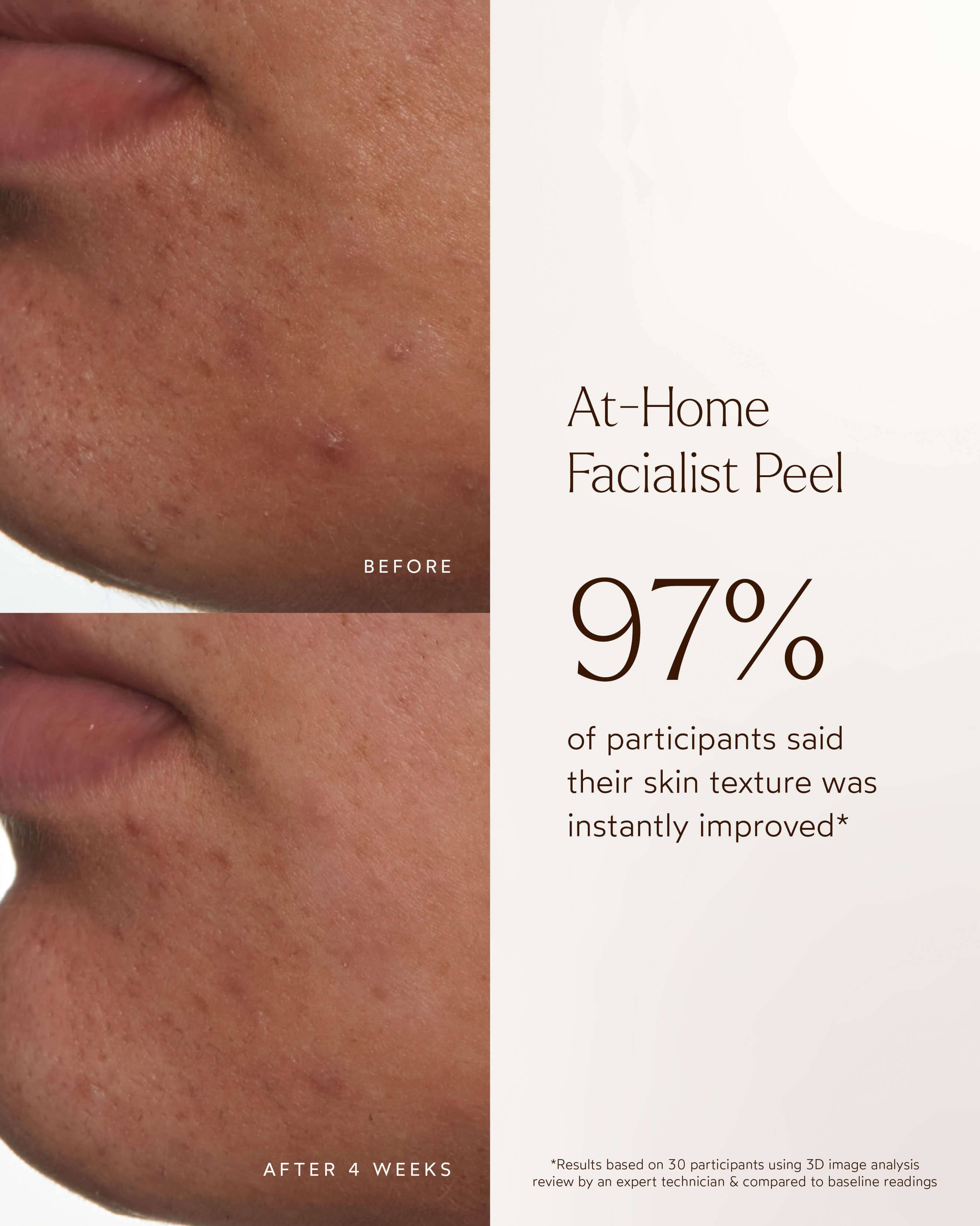 At-Home Facialist Peel 5