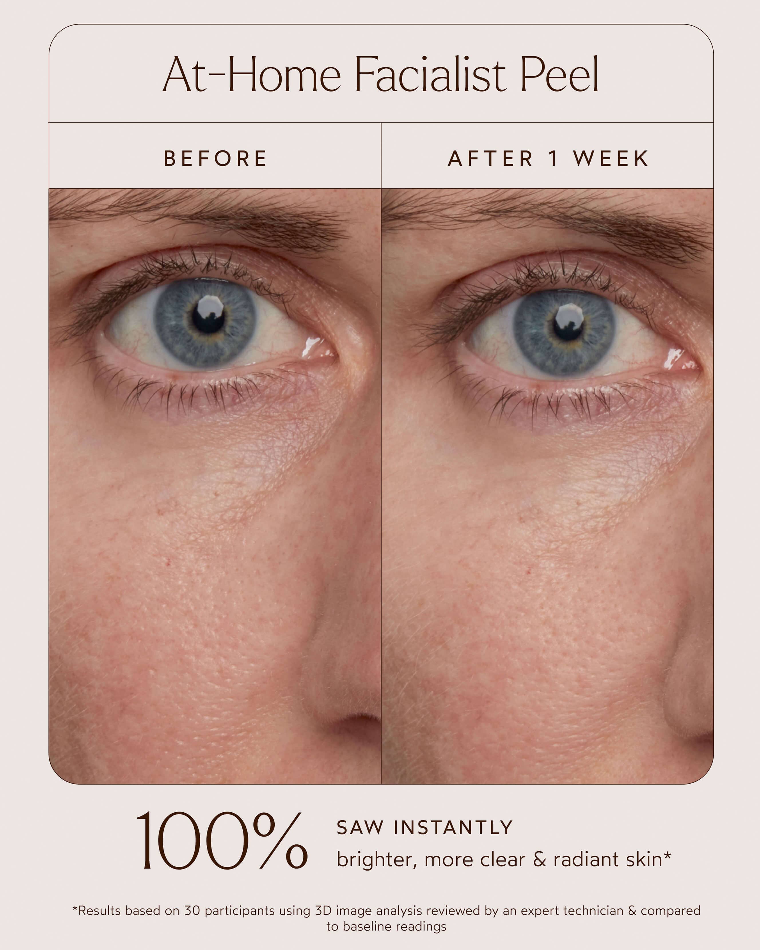 At-Home Facialist Peel 4